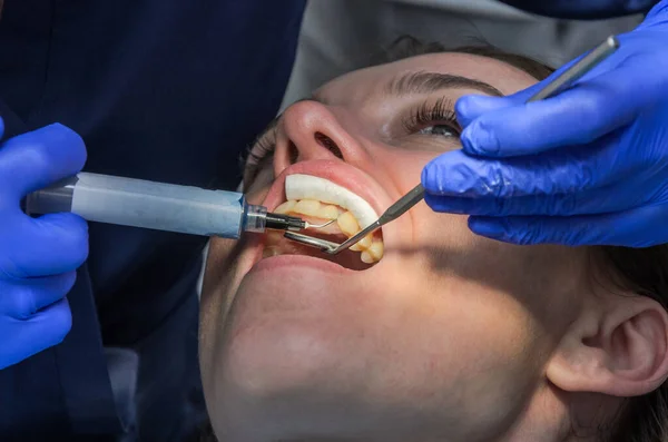 牙医治疗妇女的牙齿 — 图库照片