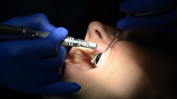 Doctor Dentist Treats Teeth Woman — Stock Video