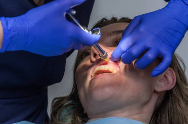 Diş hekimi, diş tedavisi sırasında hastanın diş etlerine anestezi yapar.