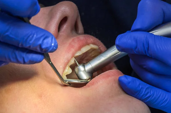 Médecin Dentiste Traite Les Dents Femme — Photo