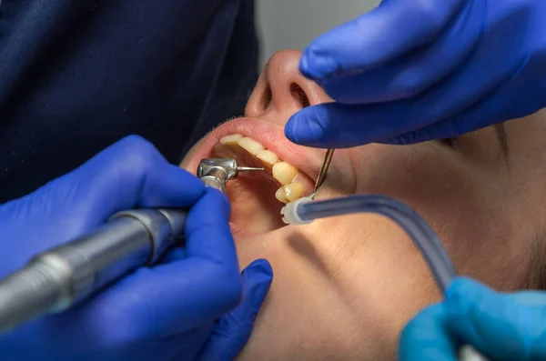 Médecin Dentiste Traite Les Dents Femme — Photo