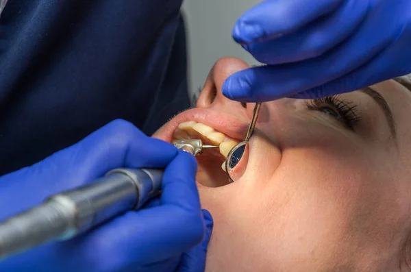 Médico Dentista Trata Los Dientes Mujer — Foto de Stock