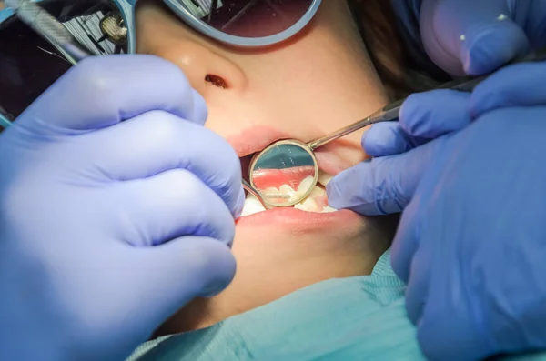 Dentista Infantil Trata Dientes Bebé — Foto de Stock