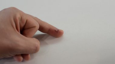 Doktor parmağındaki yarayı iyot antiseptikle tedavi eder.