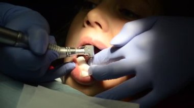 Küçük kız dişçide dişlerini tedavi eder, doktor süt dişindeki sinirleri söker.