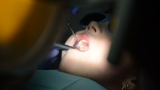 子供の歯医者は赤ん坊の歯を扱う — ストック動画