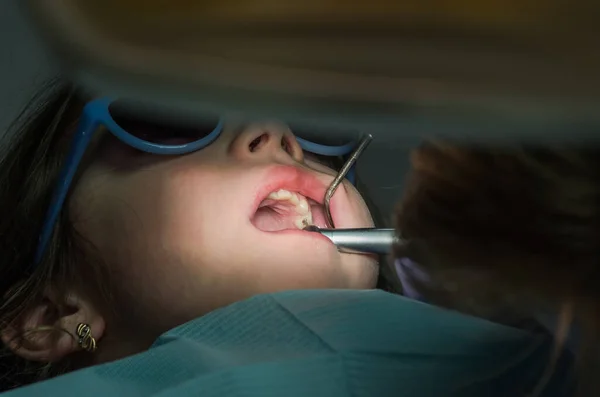 Dentista Infantil Trata Dientes Bebé — Foto de Stock