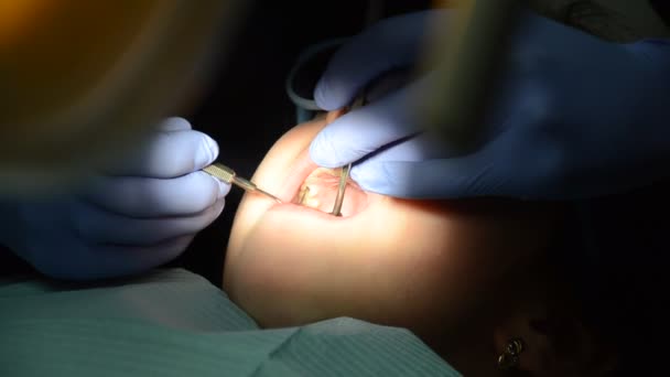 Dentista Infantil Trata Dentes Leite — Vídeo de Stock