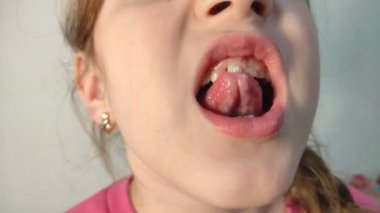 Küçük kız bebek dişini sallıyor.