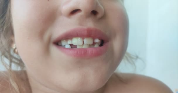 Little Girl Child Wagging Her Baby Tooth Her Tongue Which — Stok video