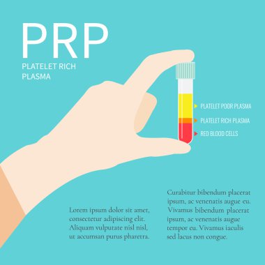 Prp ile test tüpü