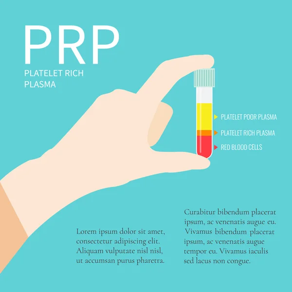 Tubo de ensayo con PRP — Vector de stock