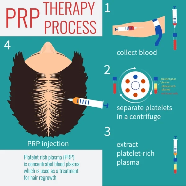 PRP injection therapy — Stock Vector