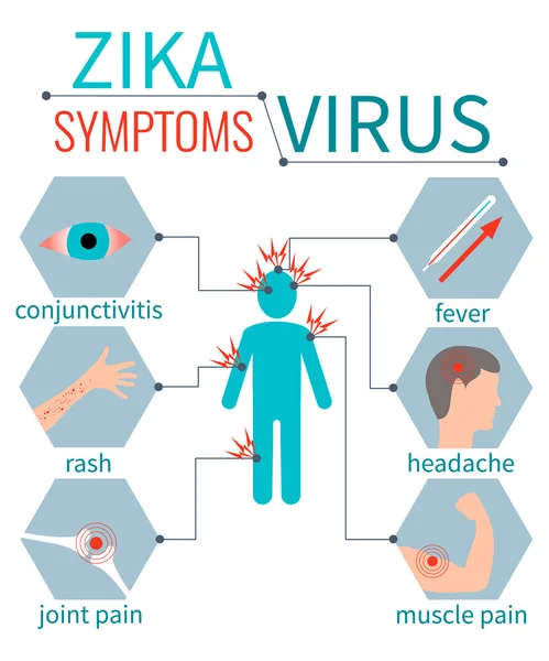 Zika vírus tünetei infografic — Stock Vector