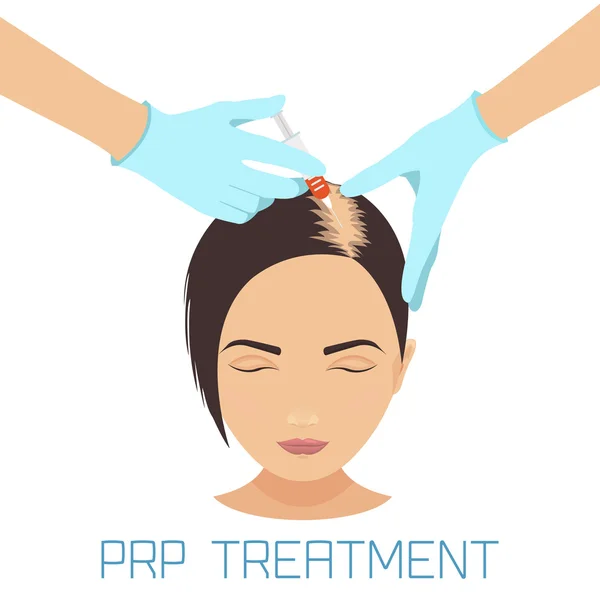 Tratamiento PRP para la pérdida de cabello — Vector de stock