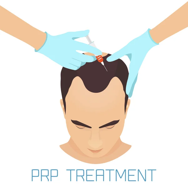 Tratamiento PRP para hombres — Vector de stock