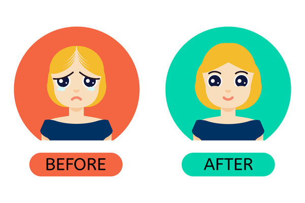 Balding woman before anf after treatment