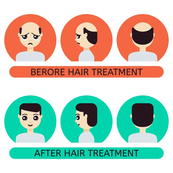 Cartoon man before and after hair treatment — Stock Vector