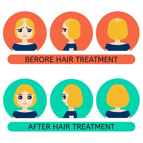 Balding woman before and after treatment — Stock Vector