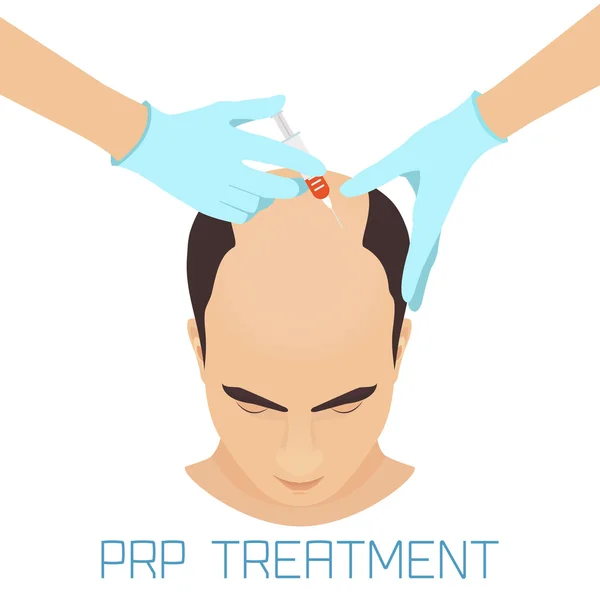 Tratamiento PRP para hombres — Vector de stock