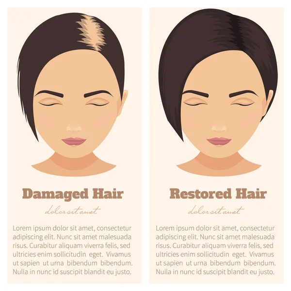 Hair loss in women — Stock Vector