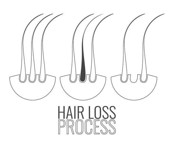 Hair follicles loss process — Stock Vector