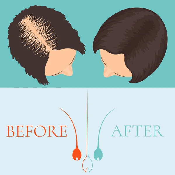 Mujer antes y después del tratamiento del cabello — Vector de stock