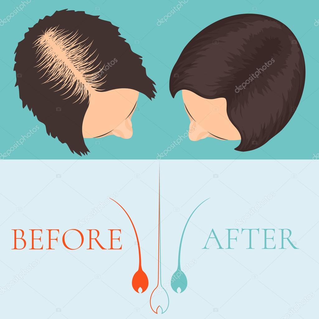 Woman before and after hair treatment