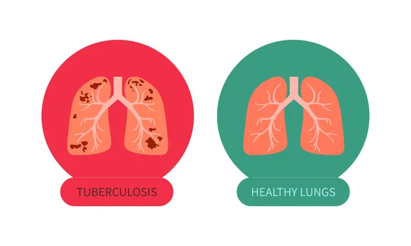Tüberküloz Sağlıklı Akciğer Sembolüne Karşı Tüberküloz Farkındalık Işareti Tıbbi Dayanışma — Stok Vektör