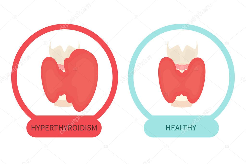 Healthy thyroid gland and hyperthyroidism symbols made in cartoon style. Front view sign. Human body organ anatomy icon. Medical concept. Vector illustration made in cartoon style.