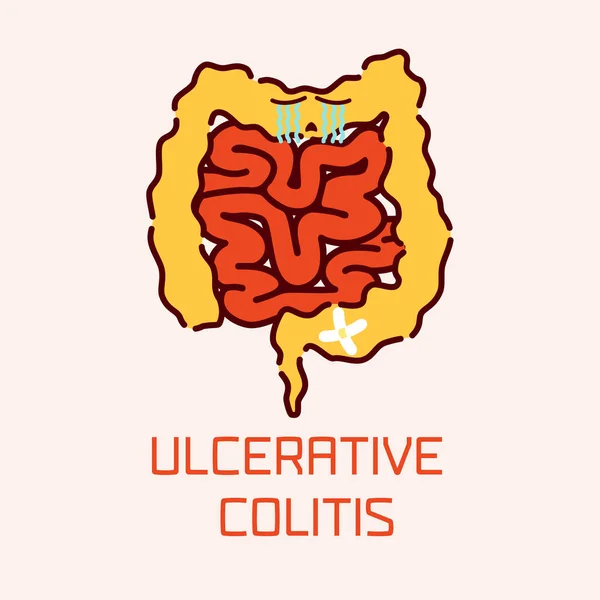 Ulcerative colitis poster - Stok Vektor