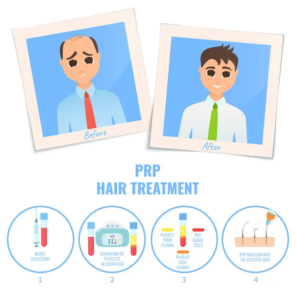 Man before and after platelet rich plasma treatment — Stock Vector