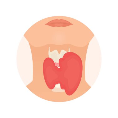 Bir kadının siluetinde tiroid bezi.