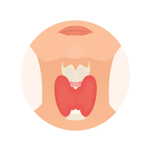 Glándula tiroidea en una silueta de una mujer — Archivo Imágenes Vectoriales