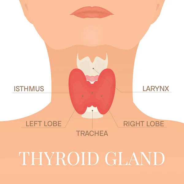 Залоза щитовидної залози в силуеті жінки — стоковий вектор