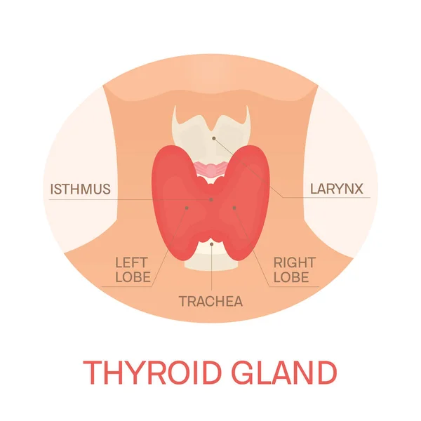 Thyroid gland in a silhouette of a woman — Stock Vector