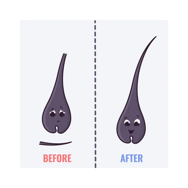 Healthy and damaged hair follicle cartoon characters — 스톡 벡터