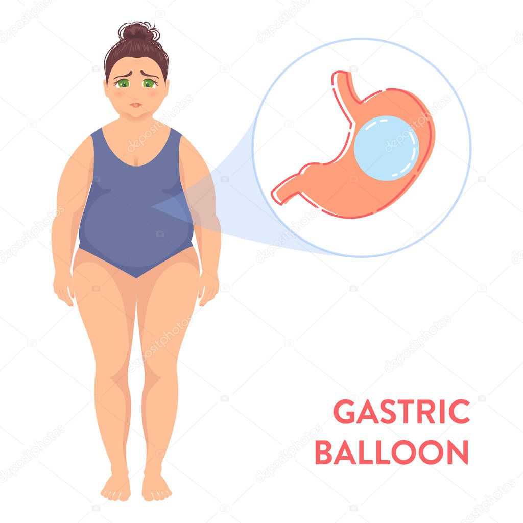 Gastric balloon weight loss procedure for women