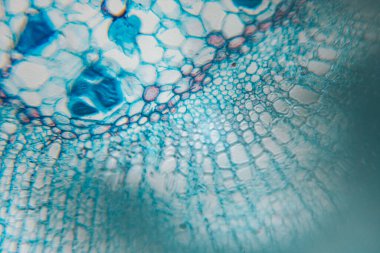 Bitki dokusunun lekeli parenksima hücrelerinin mikroskop görüntüsü, büyük, yuvarlak hücreleri ve mavi hücre duvarlarını gösteriyor..