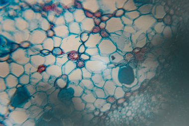 Bitki dokusunun lekeli parenksima hücrelerinin mikroskop görüntüsü, büyük, yuvarlak hücreleri ve mavi hücre duvarlarını gösteriyor..