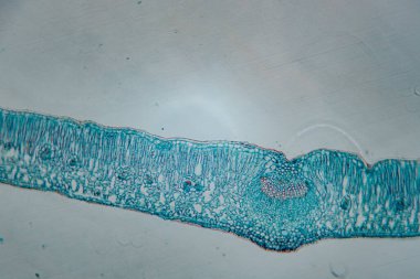 Lekeli bir yaprağın enine kesitinin son derece detaylı bir mikroskop görüntüsü. Hücre katmanlarını vurguluyor. Epidermis, Palisade ve gözenekli mezofil de dahil..