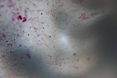 Düşük çözünürlüklü mikroskobik görüntü belirsiz hücre yapılarını, küçük parçacıkları ve sisli bir alanda dağınık enkazı gösteriyor. Görüntü biraz bulanık..