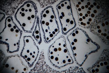 Salgı bezleri ve evimsi yapıları gösteren, hücrelerin detaylı gözlemi için kahverengi ve mavi boyalarla boyanmış bitki dokusunun yüksek büyütülmüş görüntüsü..
