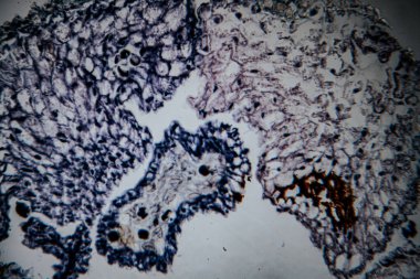 Salgı bezleri ve evimsi yapıları gösteren, hücrelerin detaylı gözlemi için kahverengi ve mavi boyalarla boyanmış bitki dokusunun yüksek büyütülmüş görüntüsü..