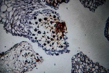 Salgı bezleri ve evimsi yapıları gösteren, hücrelerin detaylı gözlemi için kahverengi ve mavi boyalarla boyanmış bitki dokusunun yüksek büyütülmüş görüntüsü..