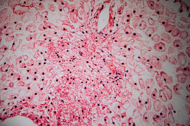 Kırmızıya boyanmış kalp kası dokusunun mikroskobik görüntüsü dallanmış kas liflerini, merkezde bulunan çekirdekleri ve histolojik analiz için ayrılmış diskleri gösteriyor..