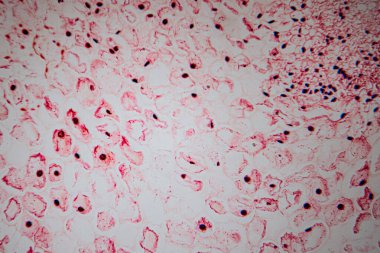 Kırmızıya boyanmış kalp kası dokusunun mikroskobik görüntüsü dallanmış kas liflerini, merkezde bulunan çekirdekleri ve histolojik analiz için ayrılmış diskleri gösteriyor..