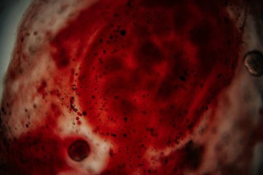 Kırmızı lekeli kıkırdak dokunun mikroskobik görüntüsü yoğun bir matris ve dağınık parçacıklarla çevrili kondroksit parçalarını gösteriyor..