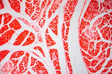 Microscopic view of dense connective tissue showing parallel collagen fibers, fibroblasts, and blood vessels, stained red to show structural and cellular details.