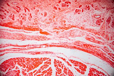 Paralel kolajen liflerini, fibroblastları ve kan damarlarını gösteren yoğun bağ dokusunun mikroskobik görüntüsü, yapısal ve hücresel detayları göstermek için kırmızıya boyanmış..